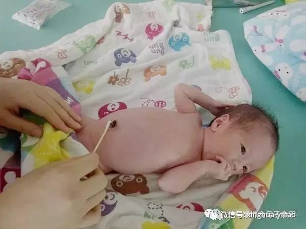 最新脐带消毒方法及爱的纽带温馨日常